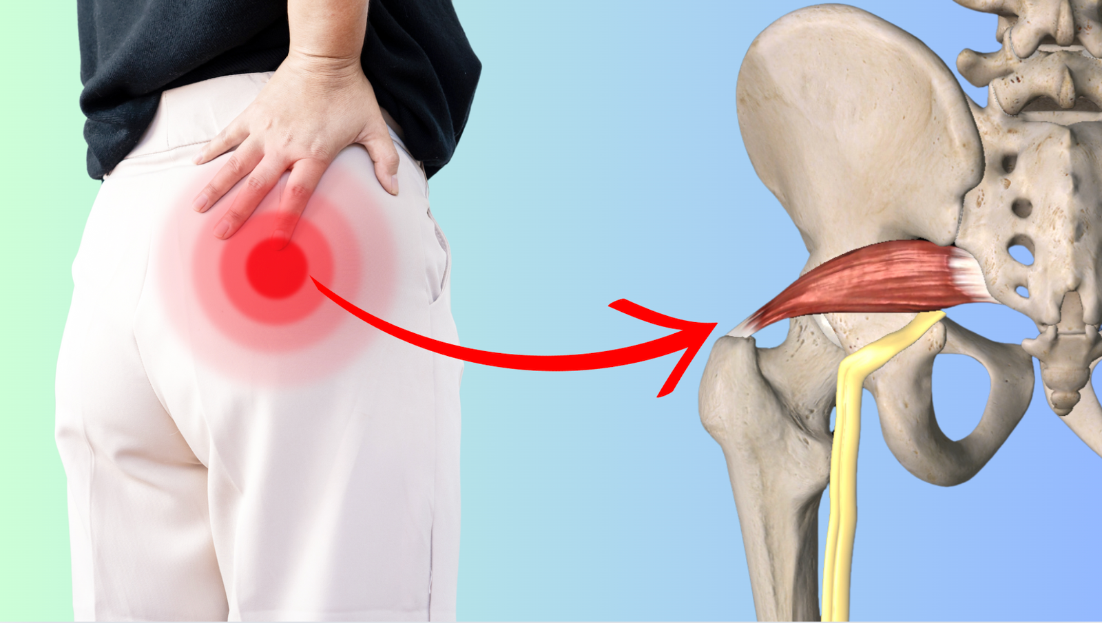 Tight piriformis pain